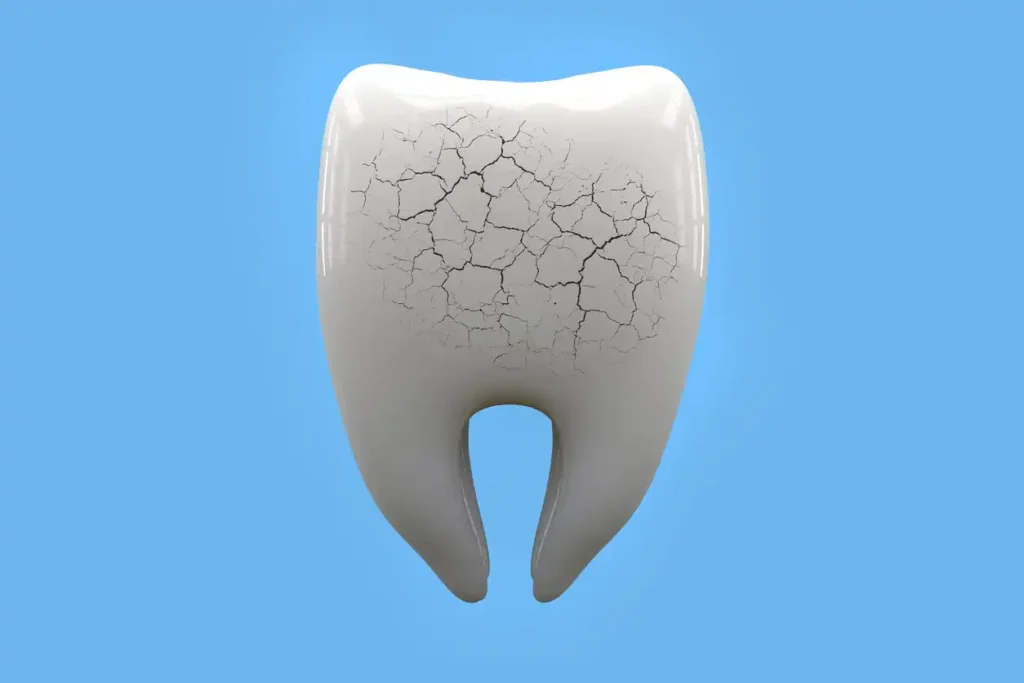 Hábitos que dañan el esmalte dental sin que te des cuenta