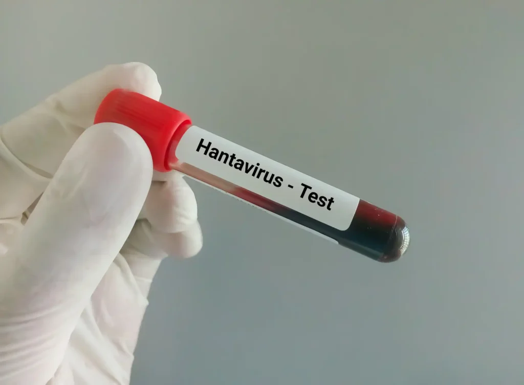 Hantavirus en España: gestión gubernamental, transparencia sanitaria y riesgos legales